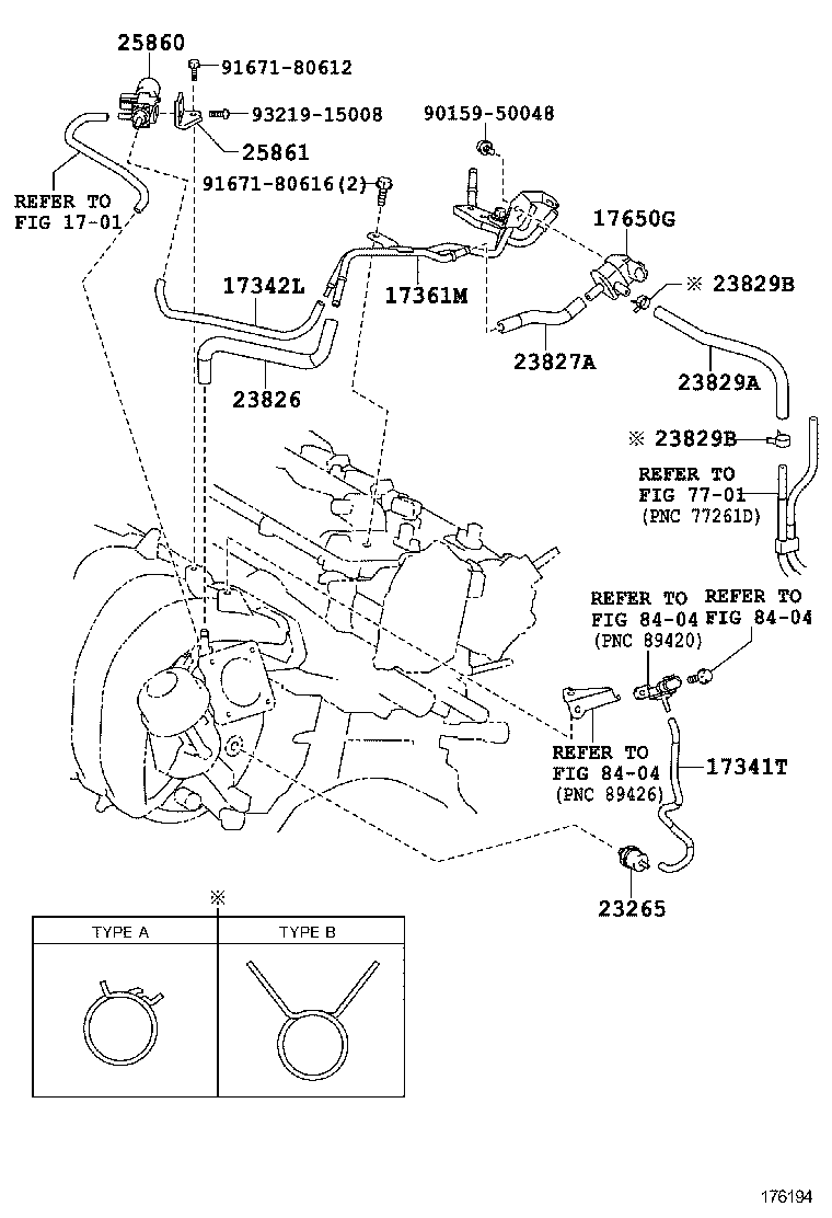  AURIS HYBRID UKP |  VACUUM PIPING