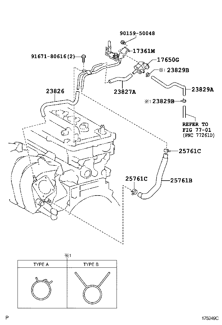  AURIS HYBRID UKP |  VACUUM PIPING